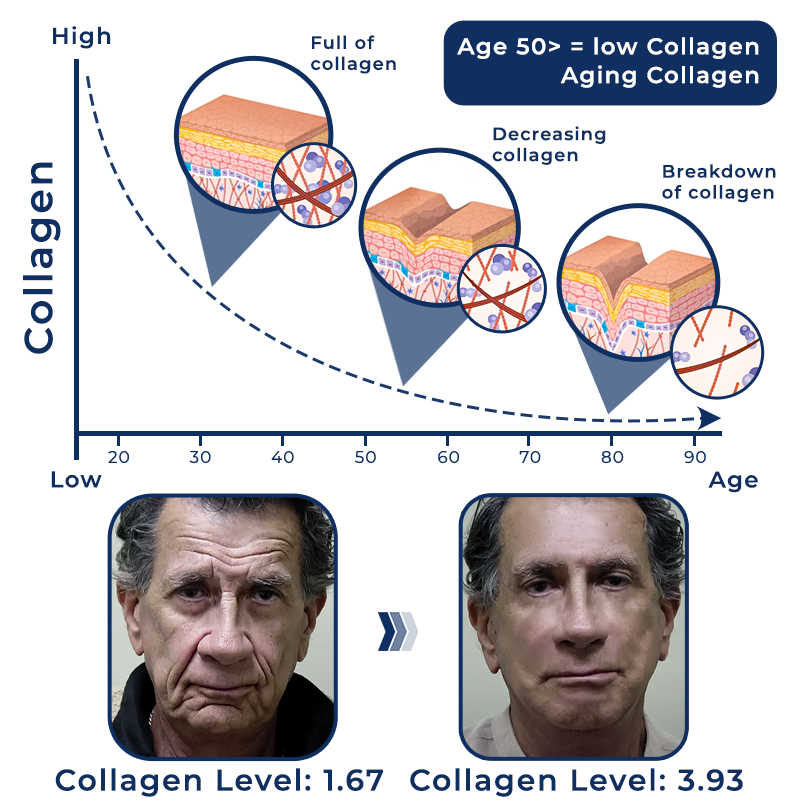 flysmus™ Collagen Refill Pro Face Créme Homme